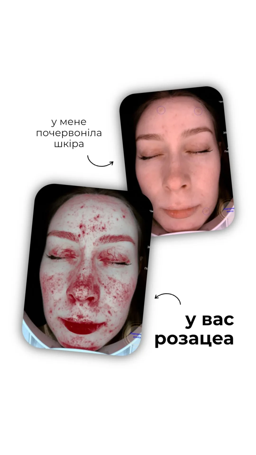 😮 Скільки проблем зі шкірою ви можете не помічати, поки вони ще не проявилися зо