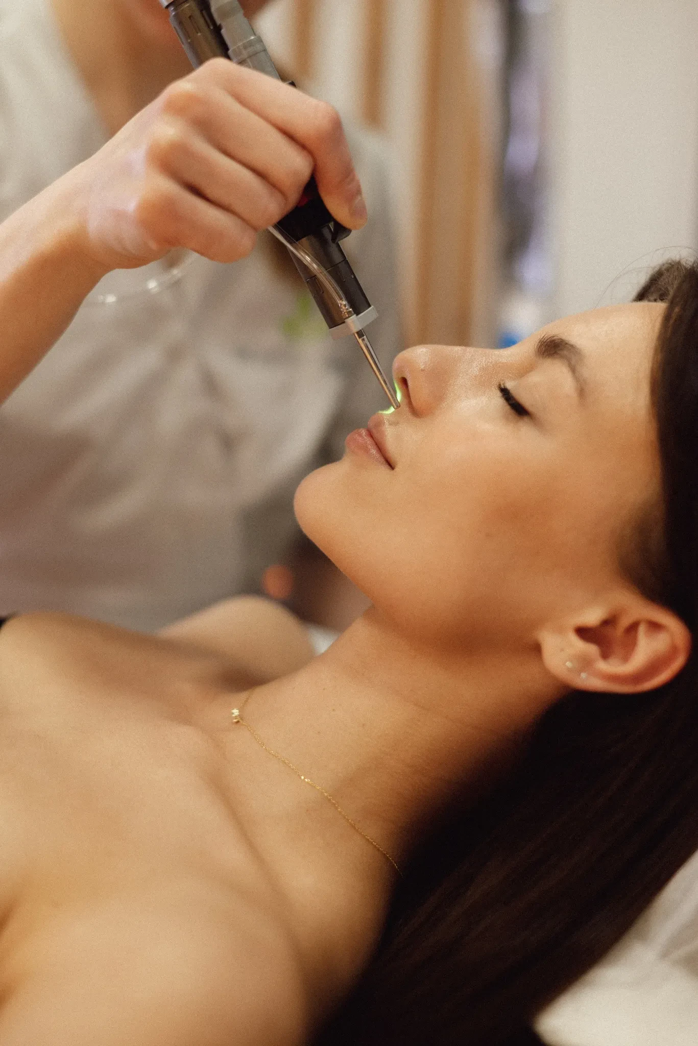Процедура лазерної епіляції верхньої губи у Beauty Laser